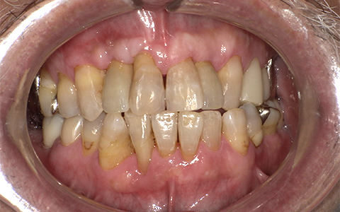 After image