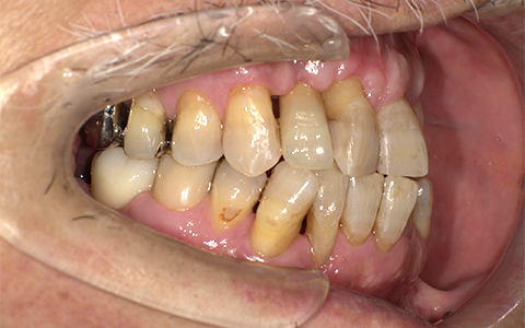 After image