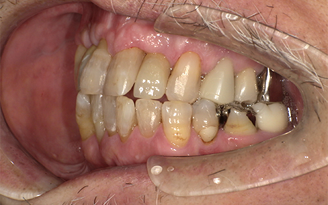 After image