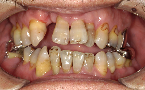 Before image