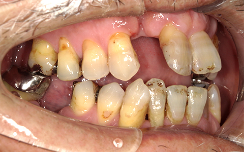 Before image