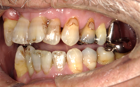 Before image