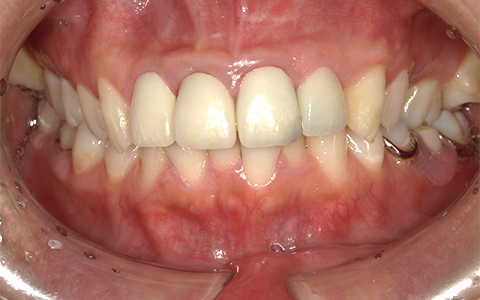 After image
