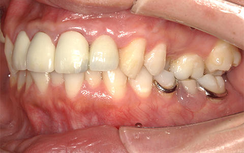 After image
