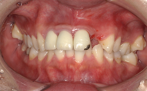 Before image