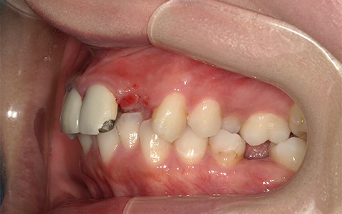 Before image