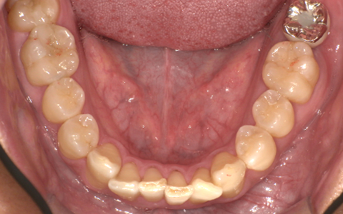 After image
