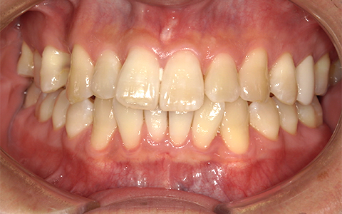 Before image