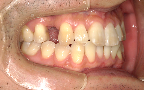 Before image