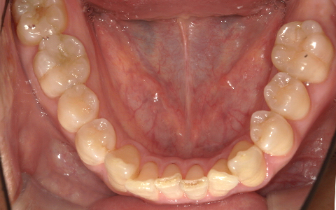 Before image
