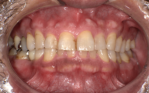 After image