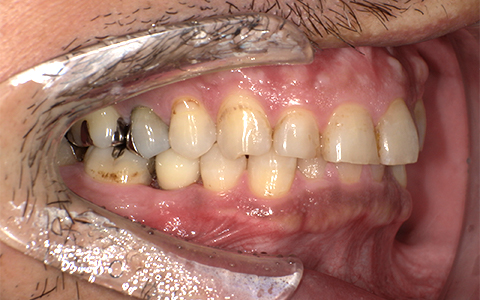 After image