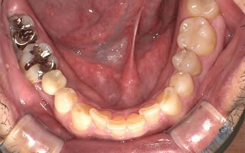 After image