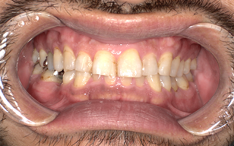 Before image