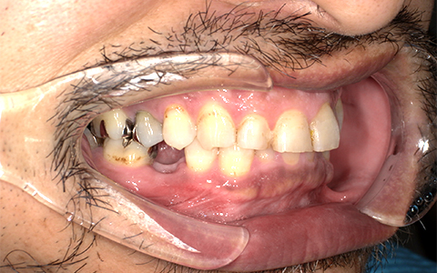 Before image