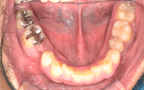 Before image