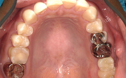 After image