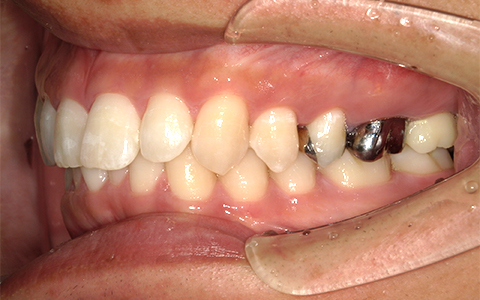 After image