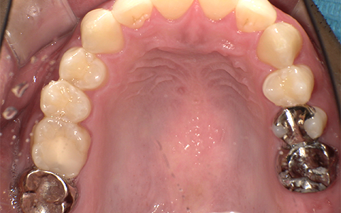 Before image