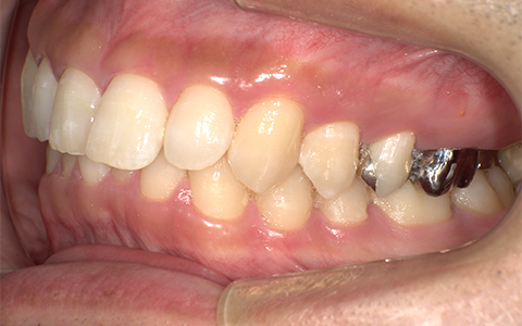Before image