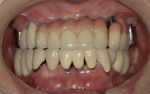 After image