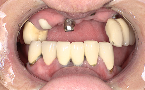 Before image