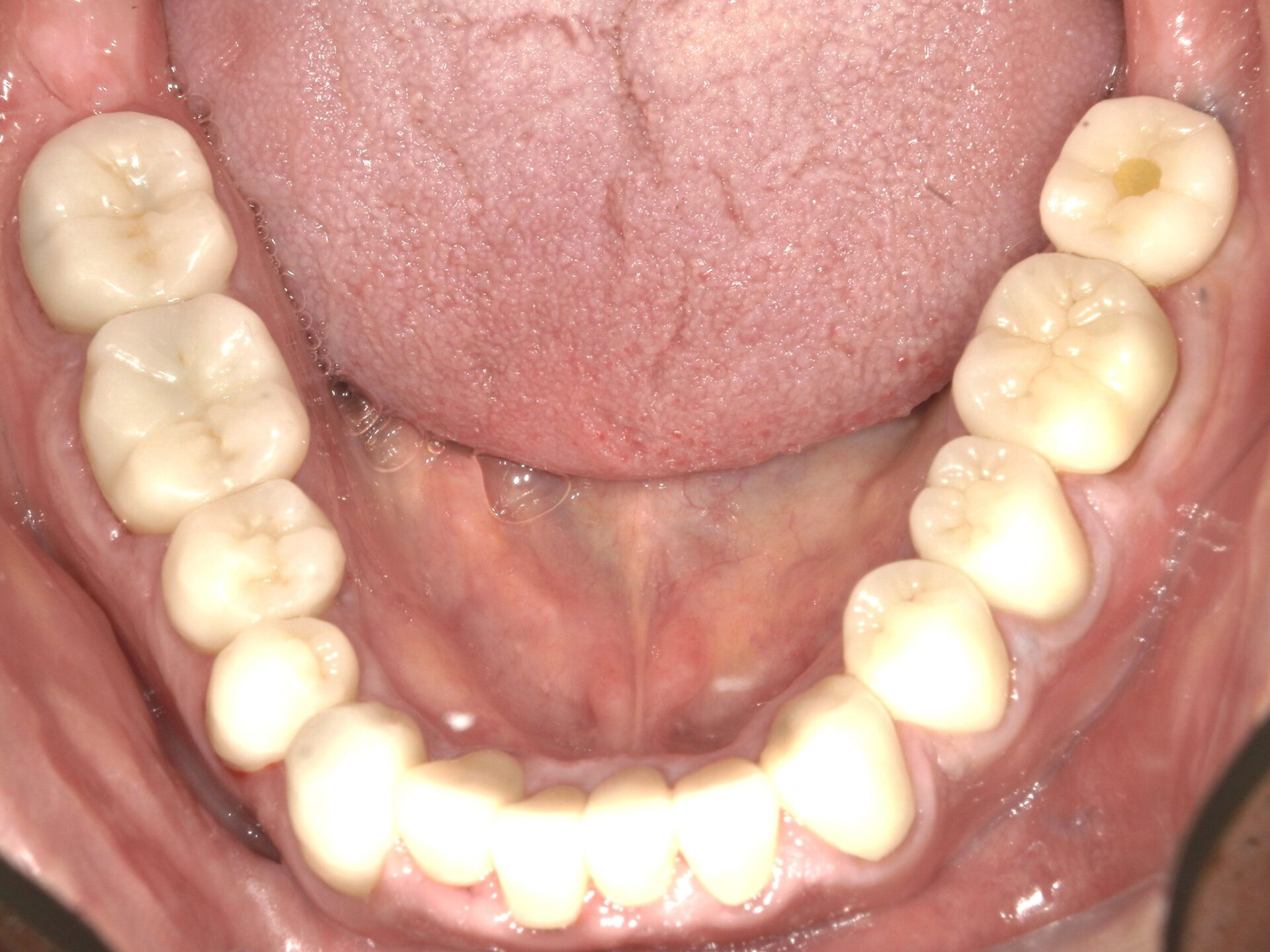 After image