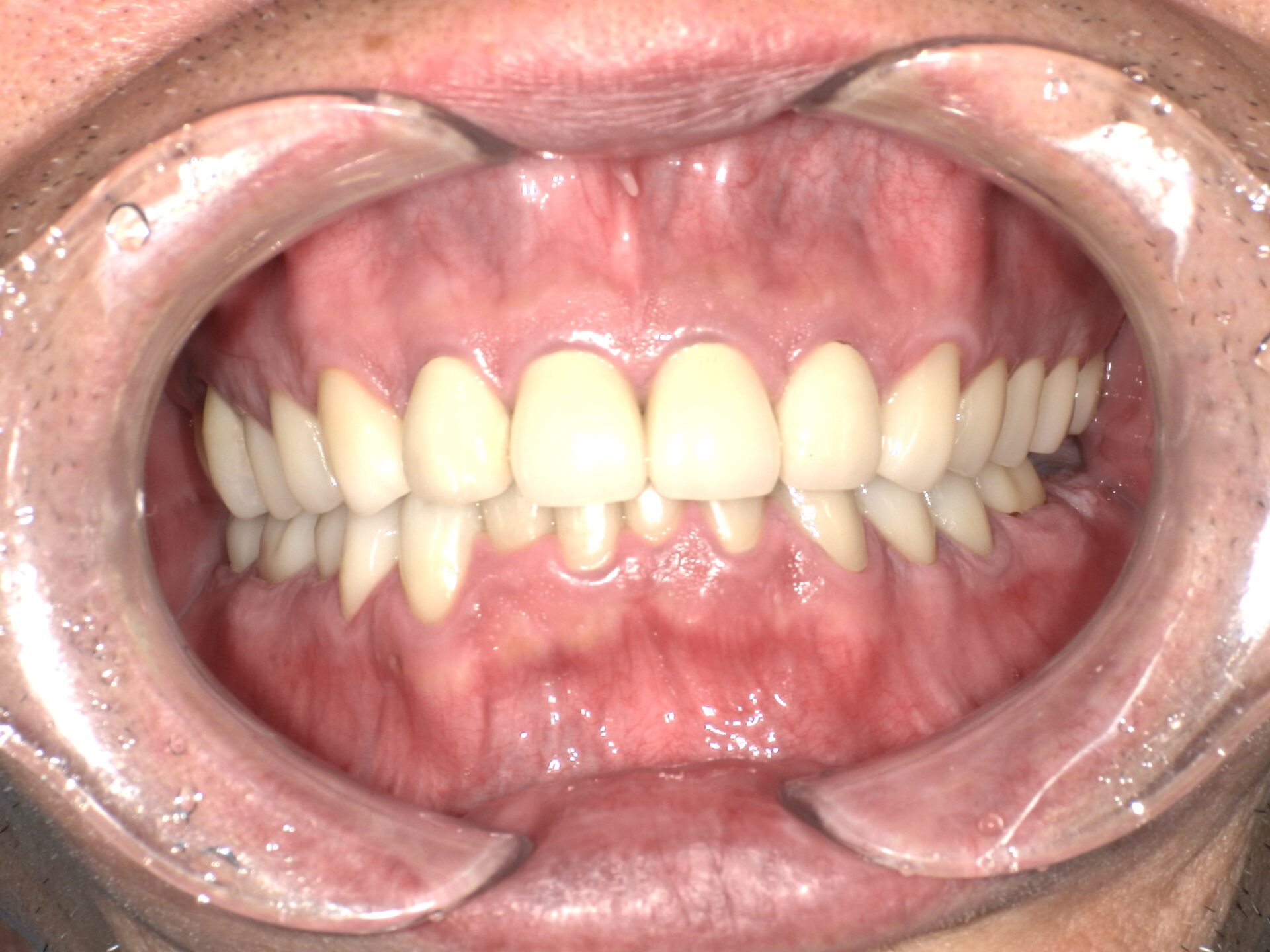 Before image