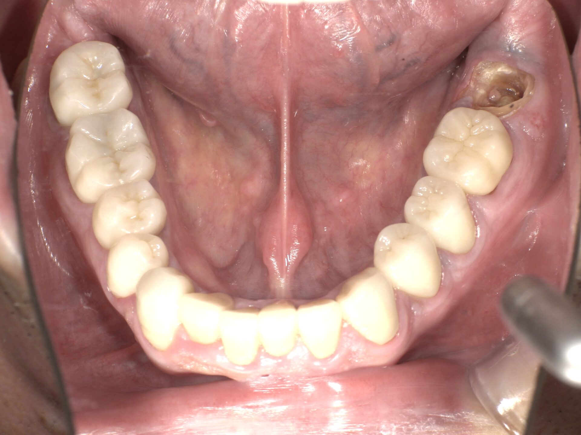 Before image