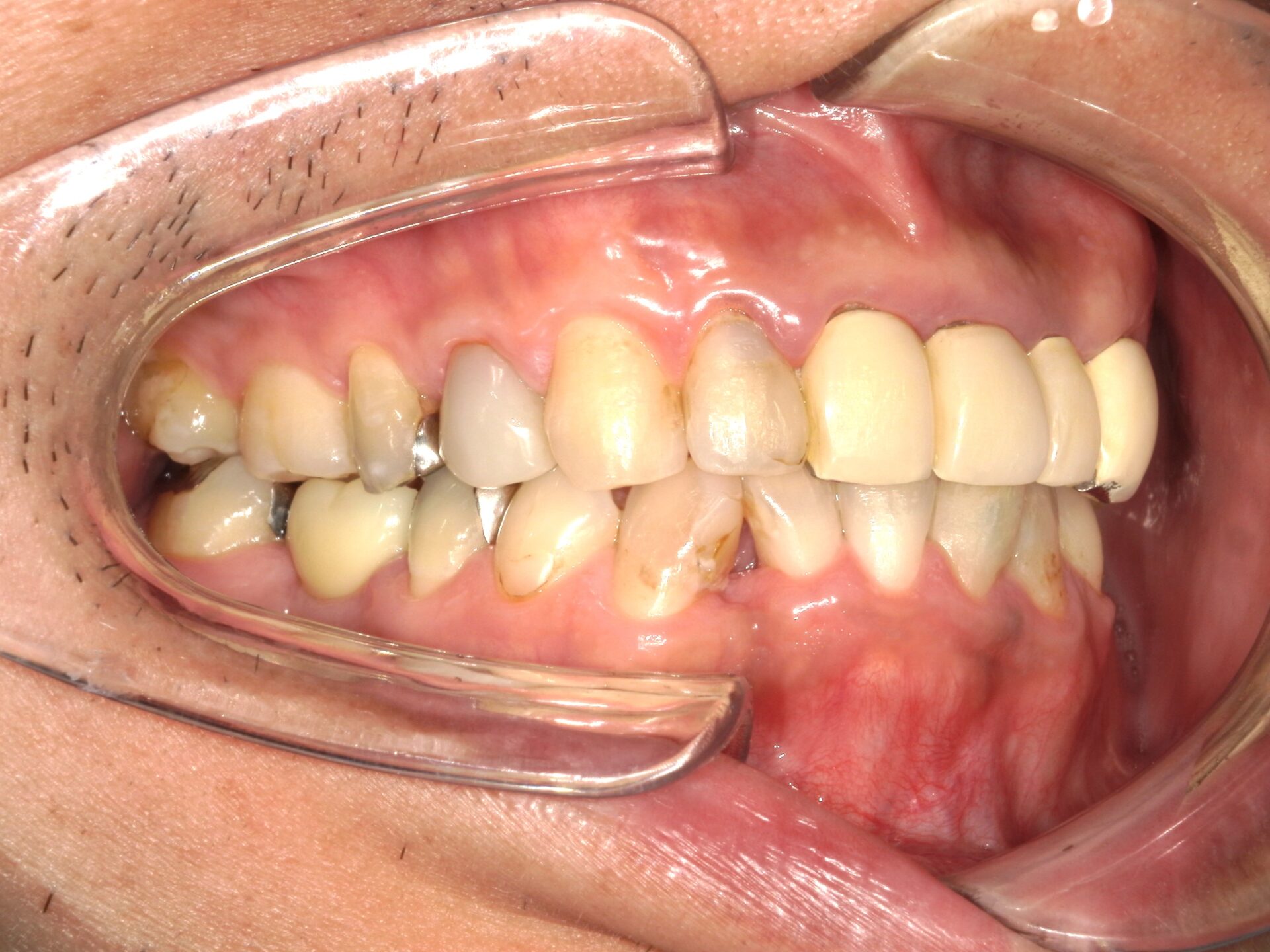 After image