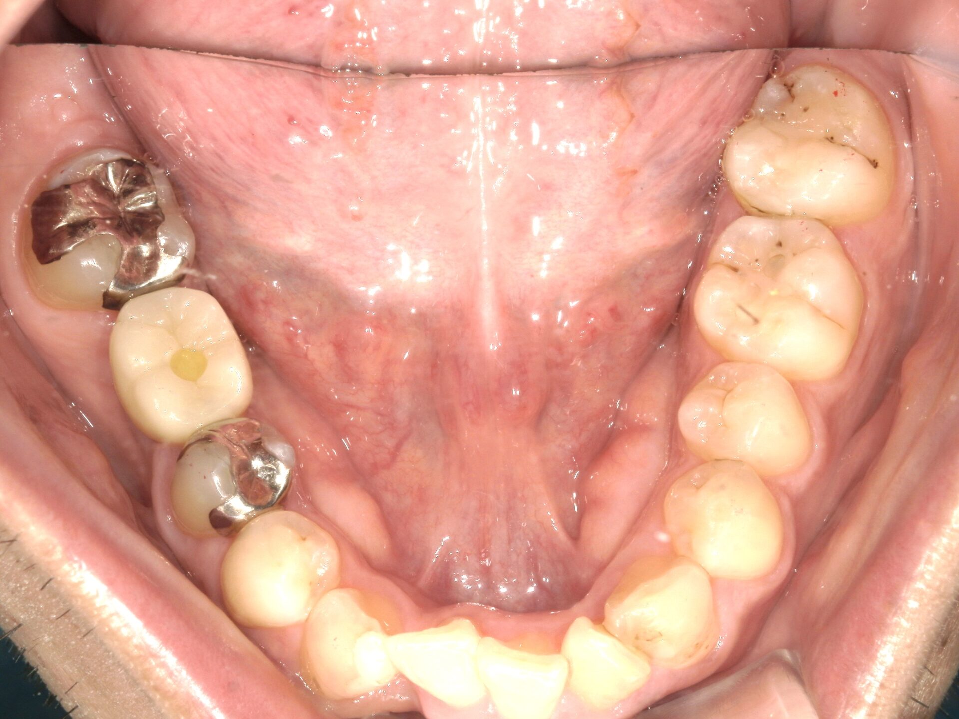 After image