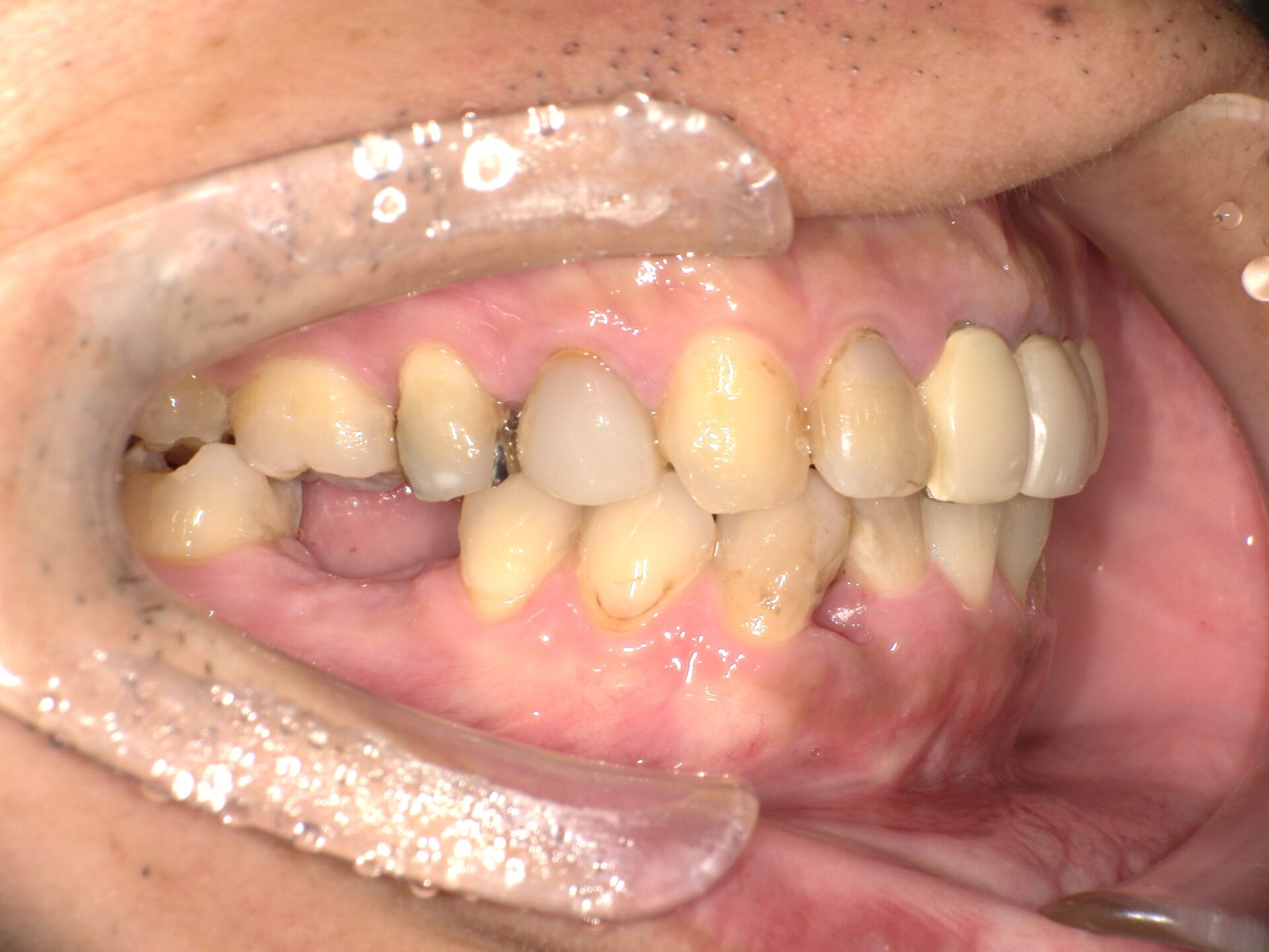 Before image