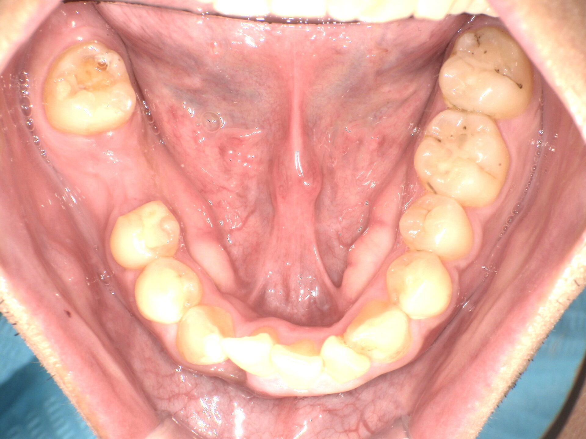 Before image