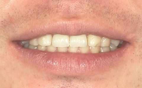 After image
