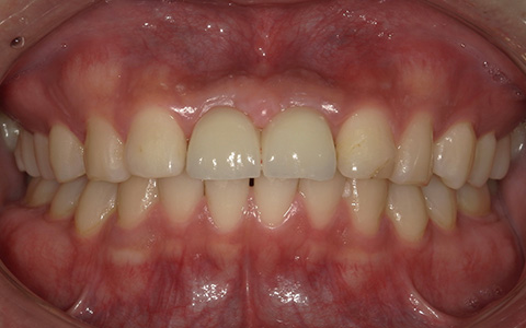 After image
