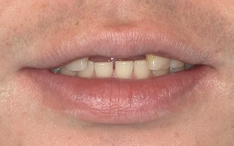 Before image