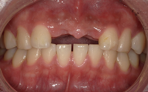 Before image