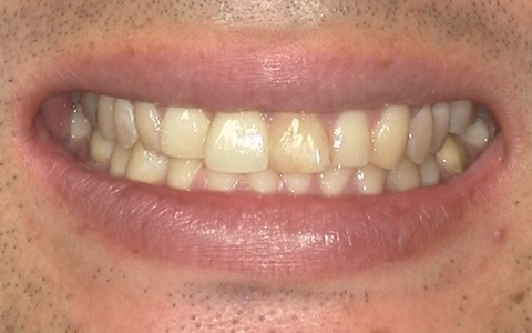 After image