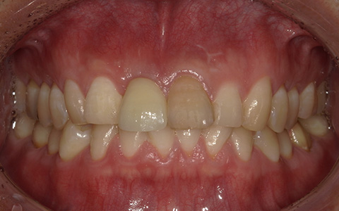 After image