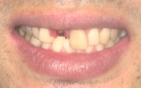 Before image
