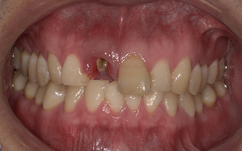 Before image
