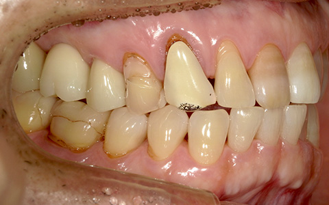 After image