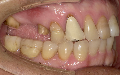 Before image