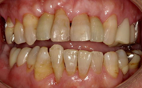 After image