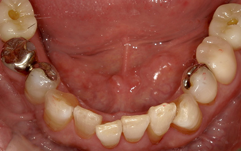 After image