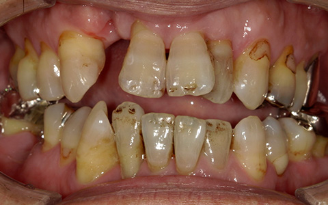 Before image