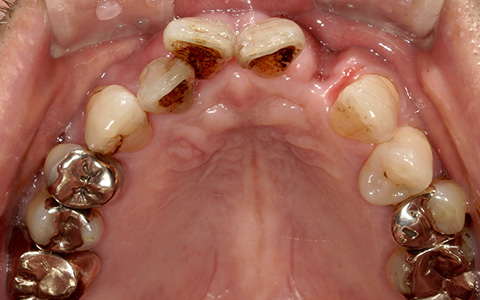 Before image