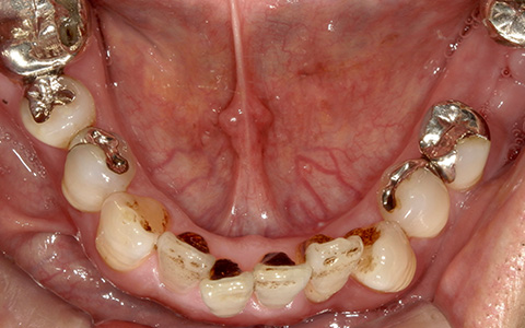 Before image