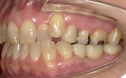 After image