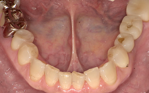 After image